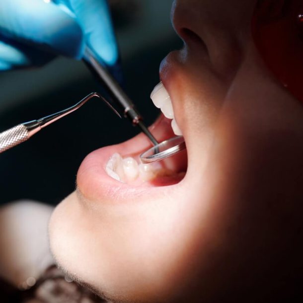 Ile kosztuje leczenie zębów pod narkozą?