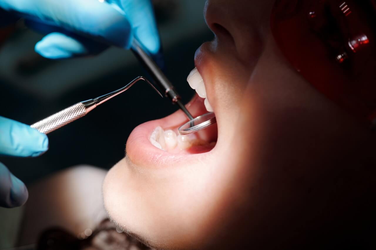 Ile kosztuje leczenie zębów pod narkozą?